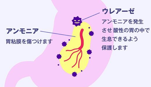 【健康】ピロリ菌の話①