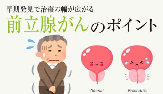 【健康】前立腺がんは早期発見で治る